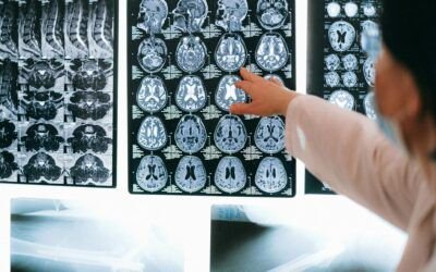 La Neurogénesis Neurocampal: la formación de nuevas neuronas en cerebro adulto