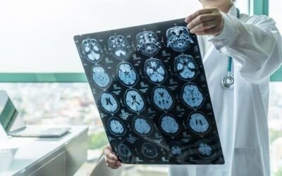 Detección precoz del Alzheimer: clave para una mejor calidad de vida